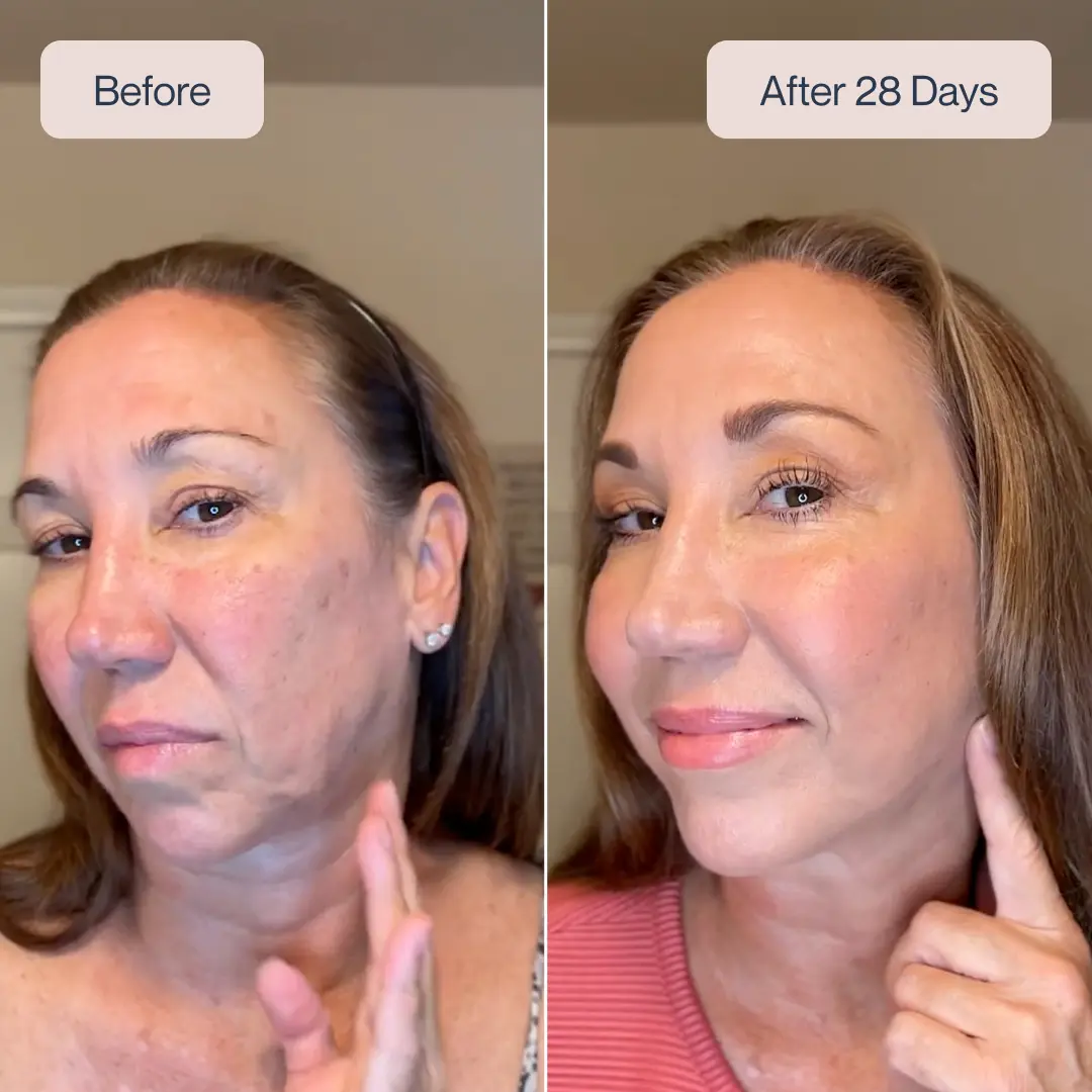 InnirSkin LED Skin Lift Pro